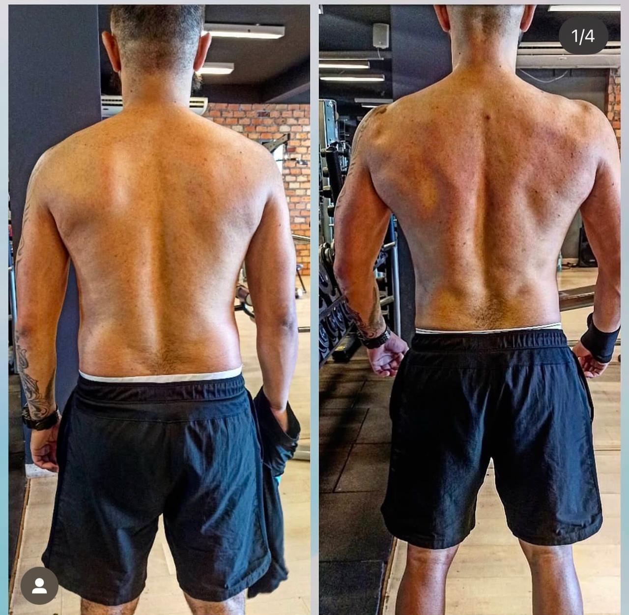 Aluno antes e depois — costas